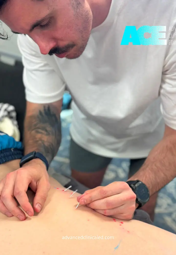 Dry Needling 2